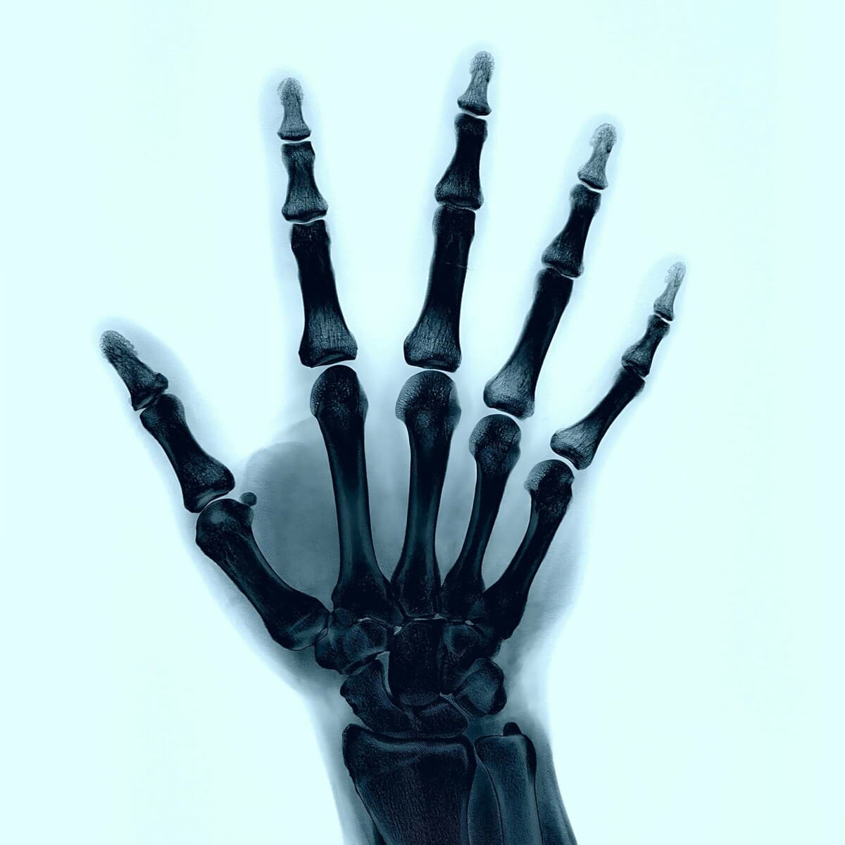 Turn Around Again - V.A VOIDWARE004